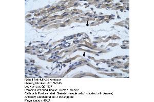 Human Muscle (NFKB2 Antikörper  (C-Term))