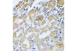 Immunohistochemistry of paraffin-embedded human stomach using BCR antibody at dilution of 1:100 (x40 lens).