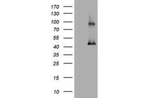 Image no. 1 for anti-Melanoma Antigen Family A, 3 (MAGEA3) antibody (ABIN1499258) (MAGEA3 Antikörper)