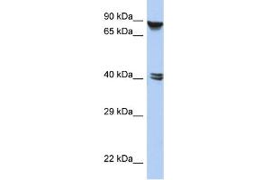 WB Suggested Anti-ZNF429 Antibody Titration:  0. (ZNF429 Antikörper  (N-Term))