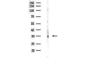 anti-Ephrin B1/B2/B3 (EFNB1/2/3) (pTyr324) antibody