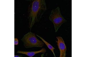 Immunofluorescence staining of methanol-fixed Hela cells using GAP43(Ab-41) Antibody. (GAP43 Antikörper)