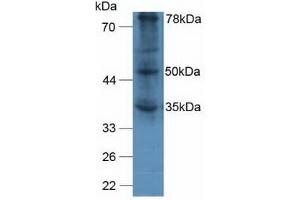 Detection of vWA2 in Human A375 Cells using Polyclonal Antibody to Von Willebrand Factor A Domain Containing Protein 2 (vWA2) (VWA2 Antikörper  (AA 457-708))
