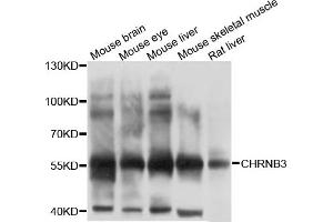 Western blot analysis of extracts of various cell lines, using CHRNB3 antibody (ABIN6003806) at 1/1000 dilution. (CHRNB3 Antikörper)