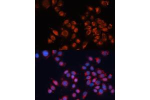 Immunofluorescence analysis of HeLa cells using Cation-independent M6PR (Cation-independent M6PR (IGF2R)) antibody (ABIN6130063, ABIN6142247, ABIN6142248 and ABIN6216853) at dilution of 1:100. (IGF2R Antikörper  (AA 2327-2491))