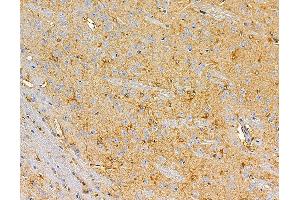 ABIN7095877 and ABIN7099939 at 1/100 staining rat brain tissue by IHC-P.