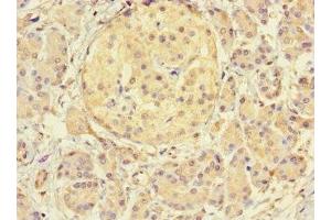 Immunohistochemistry of paraffin-embedded human pancreatic tissue using ABIN7172144 at dilution of 1:100 (THADA Antikörper  (AA 432-651))