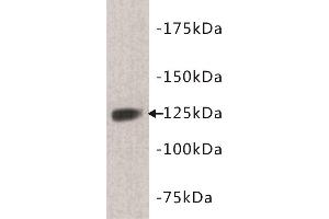 Western Blotting (WB) image for anti-tyrosine Kinase with Immunoglobulin-Like and EGF-Like Domains 1 (TIE1) (N-Term) antibody (ABIN1854998) (TIE1 Antikörper  (N-Term))