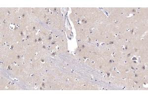 Immunohistochemistry (IHC) image for anti-Amyloid beta (A4) Precursor Protein (APP) (AA 672-711) antibody (ABIN7433024)