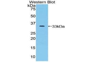 Western Blotting (WB) image for anti-Jagged 2 (JAG2) (AA 714-981) antibody (ABIN3202318) (JAG2 Antikörper  (AA 714-981))