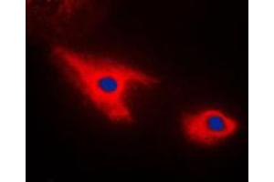 Immunofluorescent analysis of Septin 7 staining in HepG2 cells. (Septin 7 Antikörper  (C-Term))