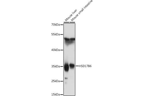 HSD17B6 Antikörper  (AA 178-317)