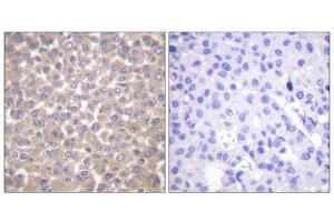 Immunohistochemistry (IHC) image for anti-TNFRSF1A-Associated Via Death Domain (TRADD) (C-Term) antibody (ABIN1848860)