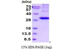 SDS-PAGE (SDS) image for Kallikrein 2 (KLK2) (AA 25-261) protein (His tag) (ABIN6387849)