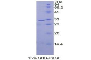SDS-PAGE (SDS) image for Dickkopf Homolog 1 (DKK1) (AA 33-266) protein (His tag) (ABIN1877227) (DKK1 Protein (AA 33-266) (His tag))