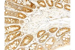 ABIN6257471 and ABIN6274750 at 1/100 staining Rat colorectal tissue by IHC-P. (RPS18 Antikörper  (C-Term))