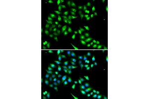 Immunofluorescence analysis of A549 cell using KIAA1456 antibody. (KIAA1456 Antikörper)