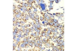 Immunohistochemistry (Paraffin-embedded Sections) (IHC (p)) image for anti-Glutamate Dehydrogenase 2 (GLUD2) (AA 319-558) antibody (ABIN6141159)