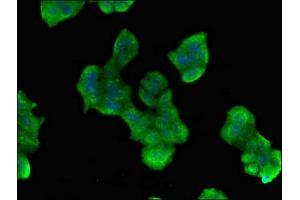 Immunofluorescent analysis of PC-3 cells using ABIN7163021 at dilution of 1:100 and Alexa Fluor 488-congugated AffiniPure Goat Anti-Rabbit IgG(H+L) (PES1 Antikörper  (AA 378-588))