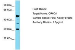Image no. 1 for anti-Olfactory Receptor, Family 6, Subfamily Q, Member 1 (OR6Q1) (C-Term) antibody (ABIN6750774) (OR6Q1 Antikörper  (C-Term))