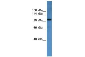 WB Suggested Anti-ZEB1 Antibody Titration:  0. (ZEB1 Antikörper  (N-Term))