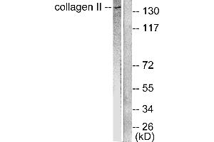 Western blot analysis of extracts from COLO205 cells, using Collagen II antibody (#C0155). (COL2 Antikörper)