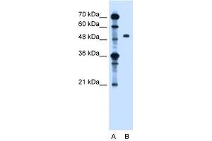 ZFYVE27 antibody used at 1. (ZFYVE27 Antikörper  (Middle Region))