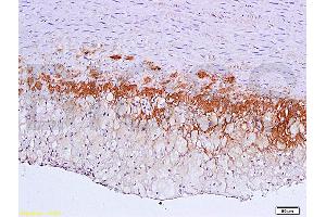 Formalin-fixed and paraffin embedded: rabbit carotid artery labeled with Anti-TGF-beta-R2/TGFBR2 Polyclonal Antibody (ABIN725225), Unconjugated 1:600 followed by conjugation to the secondary antibody and DAB staining