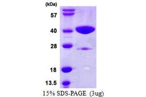 SDS-PAGE (SDS) image for Glycine N-Acyltransferase (GLYAT) (AA 1-296) protein (His tag) (ABIN667928)