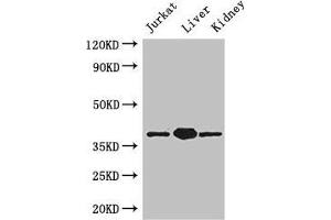Western Blot Positive WB detected in: Jurkat whole cell lysate, Mouse liver tissue, Mouse kidney tissue All lanes: PINX1 antibody at 3. (PINX1 Antikörper  (AA 151-299))