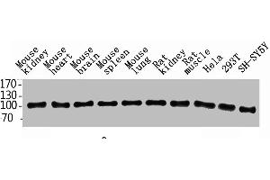 Western Blot analysis of rat-kidney hela 293T SH-SY5Y MOUSE-KIDNEY MOUSE-SPLEEN MOUSE-LUNG using ENPP3 Polyclonal Antibody. (ENPP3 Antikörper  (Internal Region))