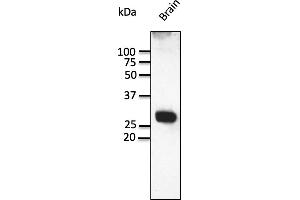 Western Blotting (WB) image for anti-RAB3A, Member RAS Oncogene Family (RAB3A) (C-Term) antibody (ABIN7272977) (RAB3A Antikörper  (C-Term))
