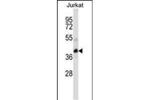 KCTD10 Antibody (C-term) (ABIN657313 and ABIN2846392) western blot analysis in Jurkat cell line lysates (35 μg/lane). (KCTD10 Antikörper  (C-Term))