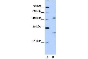 WB Suggested Anti-WBSCR1  Antibody Titration: 2.