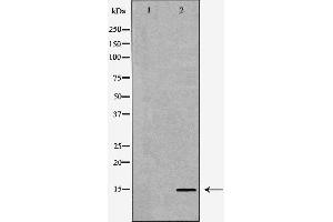 Western blot analysis of Mouse liver tissue lysates, using SPINLW1 Antibody. (Eppin Antikörper  (C-Term))
