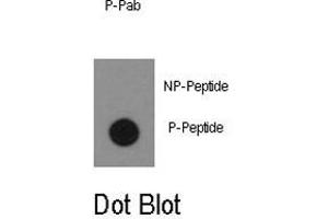 Dot blot analysis of ABL1 (phospho Y134) polyclonal antibody  on nitrocellulose membrane. (ABL1 Antikörper  (pTyr134))