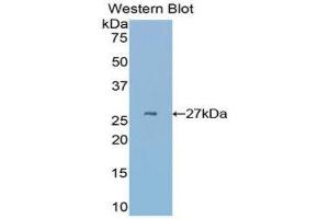 Western Blotting (WB) image for anti-Cysteine-Rich, Angiogenic Inducer, 61 (CYR61) (AA 176-379) antibody (ABIN3203381) (CYR61 Antikörper  (AA 176-379))