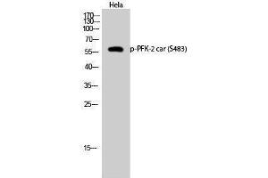 Western Blotting (WB) image for anti-6-phosphofructo-2-Kinase/fructose-2,6-Biphosphatase 2 (PFKFB2) (pSer483) antibody (ABIN3173263) (PFKFB2 Antikörper  (pSer483))