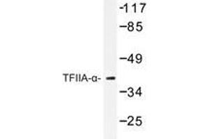 Western blot analysis of TFIIA-α antibody in extracts from RAW264. (GTF2A1 Antikörper)