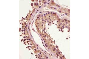 (ABIN6243510 and ABIN6578883) staining BRAF in human testis tissue sections by Immunohistochemistry (IHC-P - paraformaldehyde-fixed, paraffin-embedded sections). (BRAF Antikörper  (AA 576-606))