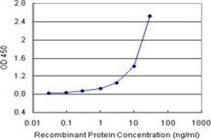 S100A8 (Human) Matched Antibody Pair