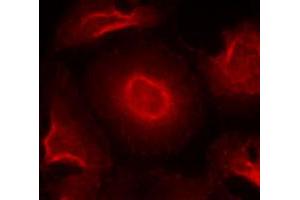 Immunofluorescence staining of methanol-fixed HeLa cells using GRIN2B polyclonal antibody (Cat # PAB12211, Red). (GRIN2B Antikörper  (Tyr1474))