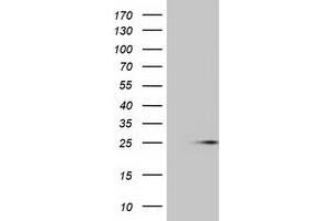 Western Blotting (WB) image for anti-MOB Kinase Activator 1B (MOB1B) antibody (ABIN1499532) (MOBKL1A Antikörper)
