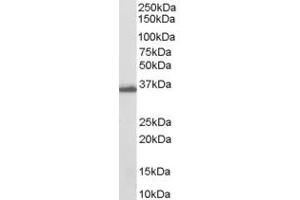 Western Blotting (WB) image for anti-Aldo-Keto Reductase Family 1, Member C3 (3-alpha Hydroxysteroid Dehydrogenase, Type II) (AKR1C3) (C-Term) antibody (ABIN185345)