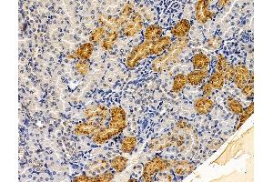 ABIN7095942 and ABIN7100004 at 1/100 staining rat kidney tissue by IHC-P. (LIMCH1 Antikörper)