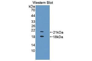 Western blot analysis of the recombinant protein. (TRPV6 Antikörper  (AA 578-725))
