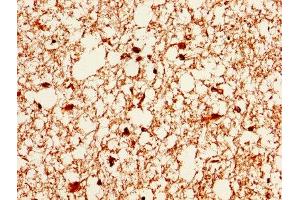 IHC image of ABIN7146715 diluted at 1:400 and staining in paraffin-embedded human brain tissue performed on a Leica BondTM system. (CA2 Antikörper  (AA 2-260))