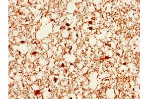 IHC image of ABIN7146715 diluted at 1:400 and staining in paraffin-embedded human brain tissue performed on a Leica BondTM system.