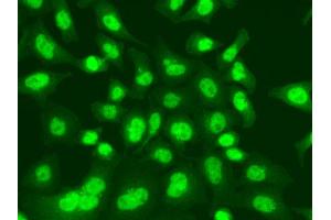 Immunofluorescence analysis of A549 cell using LIG1 antibody. (LIG1 Antikörper)