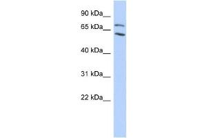 Western Blotting (WB) image for anti-Metastasis Associated 1 Family, Member 2 (MTA2) antibody (ABIN2458168) (MTA2 Antikörper)